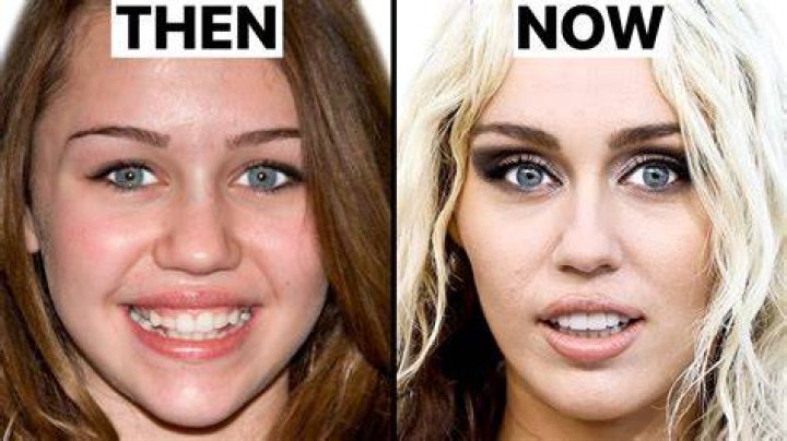 Miley Cyrus Plastic Surgery Before and After